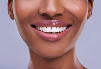 woman smiling with beautiful teeth after learning about dental implants and dentures from Surf City Oral and Maxillofacial Surgery in Huntington Beach, CA