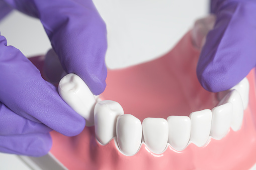 Understanding The Different Types Of Dental Extractions