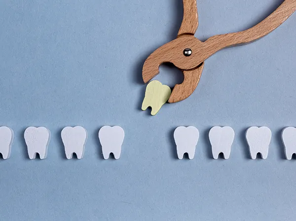 Row of wooden tooth shapes, one of which is being pulled out of the row by dental pliers at Surf City Oral and Maxillofacial Surgery in Huntington Beach, CA